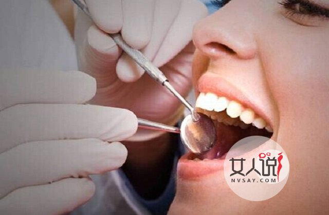 洗牙好不好别靠猜!权威专家话你知!