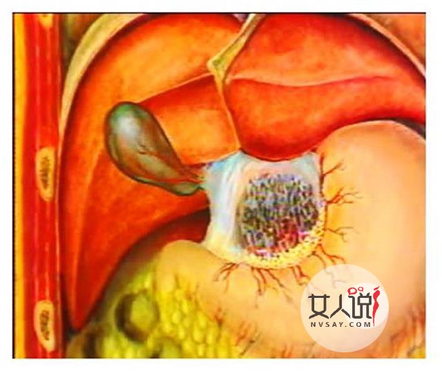 胆红素高是怎么回事?这里有你想知道的答案!