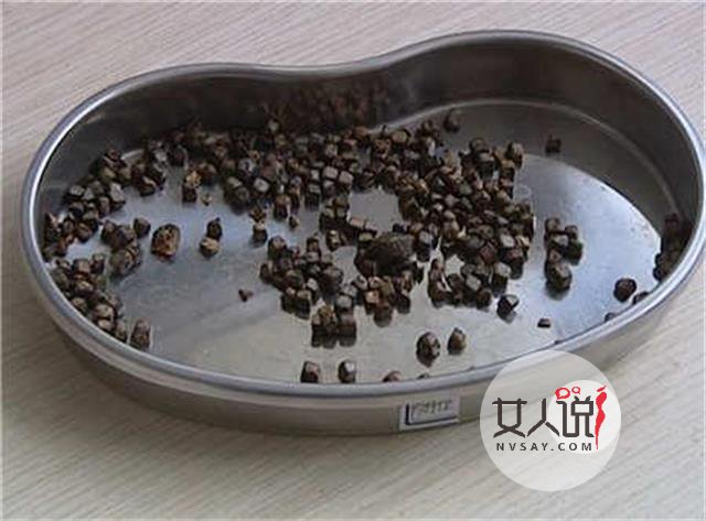 胆红素高是怎么回事？这里有你想知道的答案！