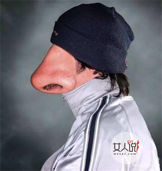 治疗鼻炎的偏方这么多,哪个适合你呢?