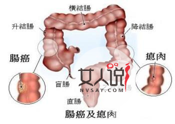 大便出血怎么办?大便出鲜血代表了什么?
