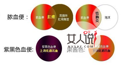 大便出血怎么办?大便出鲜血代表了什么?