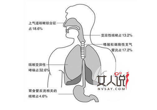 食道炎是什么?你知道食道炎的症状吗?