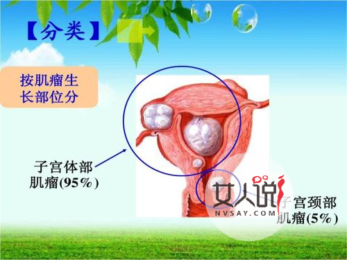 子宫肌瘤是怎么引起的,得子宫肌瘤有何症状?