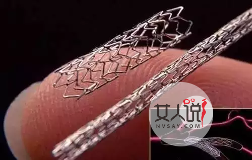 知道心脏支架是什么吗?心脏支架适应症和费用