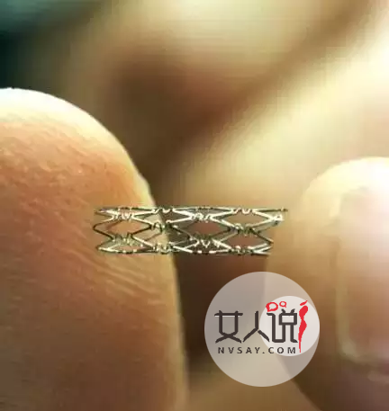 知道心脏支架是什么吗?心脏支架适应症和费用