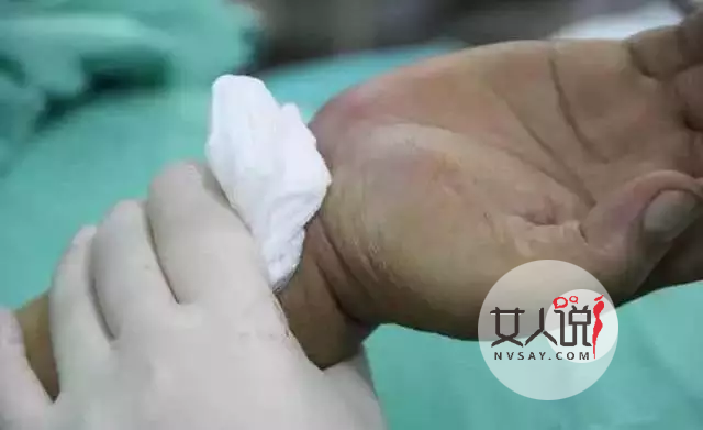 知道心脏支架是什么吗？心脏支架适应症和费用