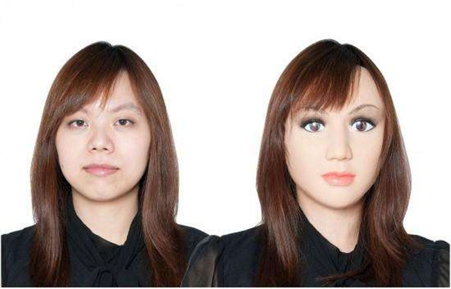 娇玛仕玻尿酸毁容案例 玻尿酸毁容事件图片曝光整容需谨慎