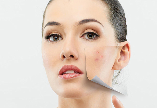 痘痘不挤自己会好吗 除了挤和自愈小编再分享别的方法