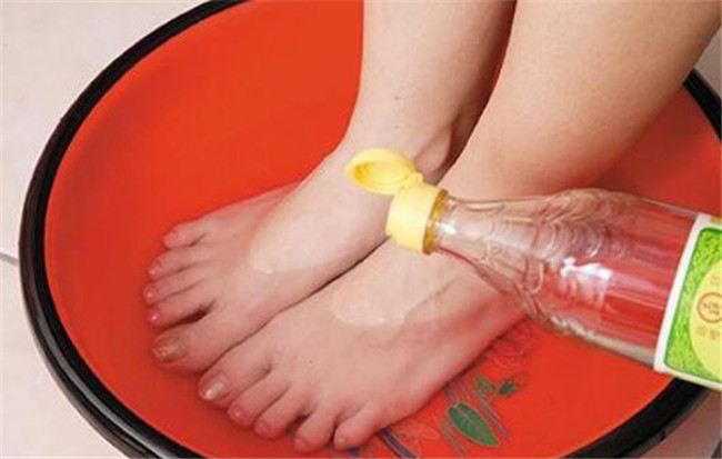 白醋泡脚可以减肥吗 既调理身心又美体瘦身值得一试