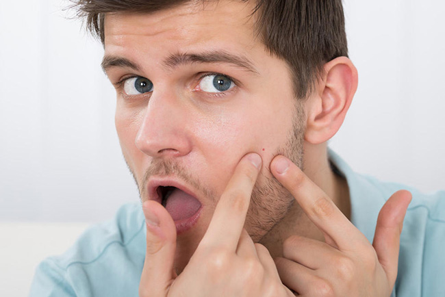 痘痘挤出来的白色东西是什么 戳进来小编带你涨姿势