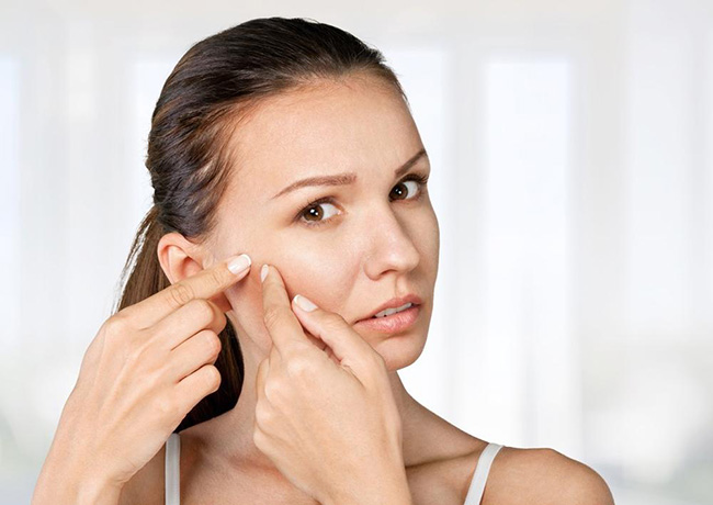 脸上长痘痘是什么原因 日常作死坏习惯莫再犯了