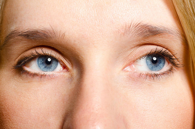 开外眼角需要缝线吗 爱美MM搞清楚再决定手术哦