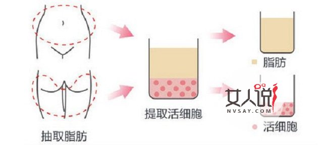 额头填充那些帮你变的更美丽的小秘密,你知道吗?