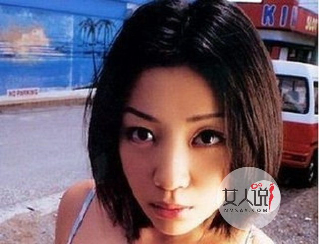 缩小鼻翼多少钱?有什么需要注意的吗?有效果吗