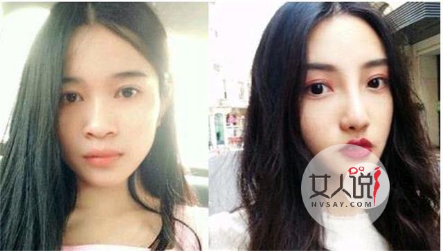 鼻子不完美？可以选择鼻部整形呀！