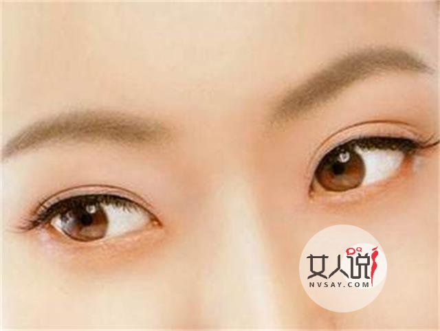 双眼皮埋线是什么,可以变好看吗?