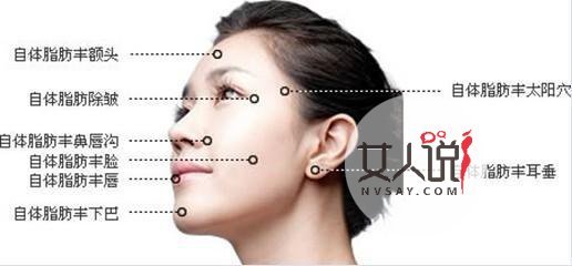自体脂肪面部填充术靠谱吗?爱美的你快来看看
