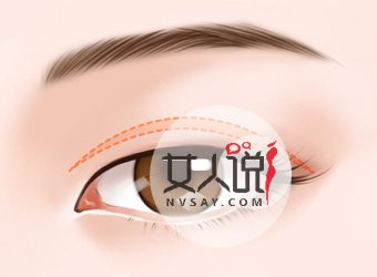 想要变美的你,了解韩式三点双眼皮价格吗?