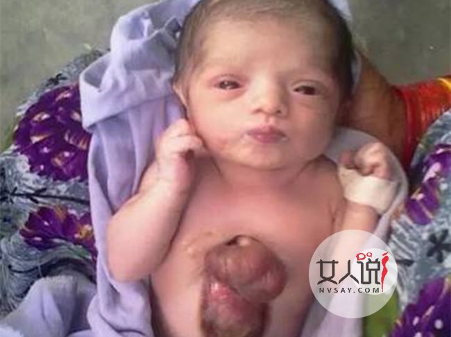 新生女婴心脏长胸外 全家陷入崩溃背后的真相令人震惊