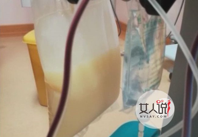 体内抽出牛奶血 不良饮食习惯竟出现白色液体血液