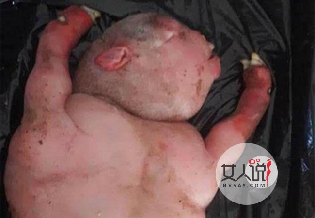 南非惊现地狱怪胎 来自地狱的怪物背后真相令人震惊