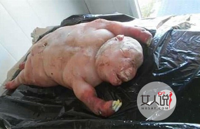 南非惊现地狱怪胎 来自地狱的怪物背后真相令人震惊