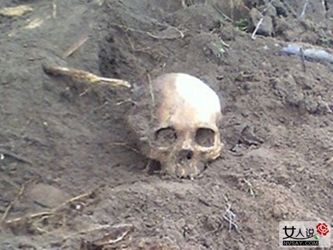 内蒙高校发现骷髅 深约一米的大坑发现骷髅头