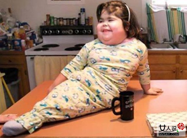 妈妈怀上人鱼宝宝 或因遗传基因致畸形不能生存下来