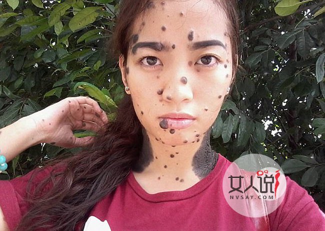 女子全身长满斑点 真人照片曝光很恐怖却满怀信心成环球小姐