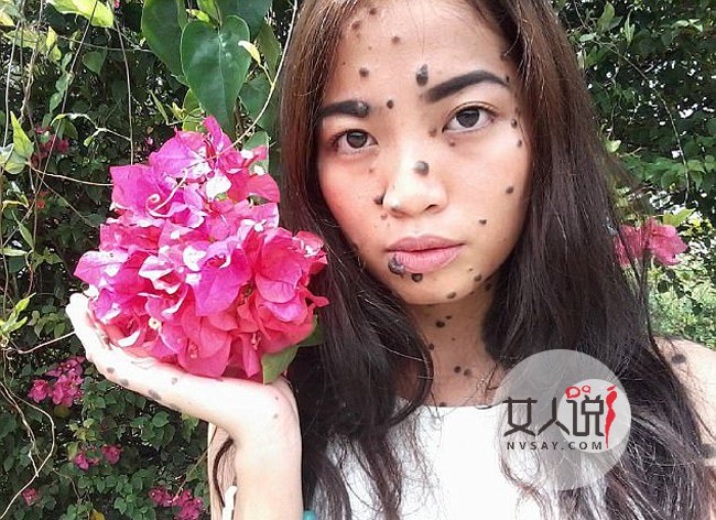 女子全身长满斑点 真人照片曝光很恐怖却满怀信心成环球小姐