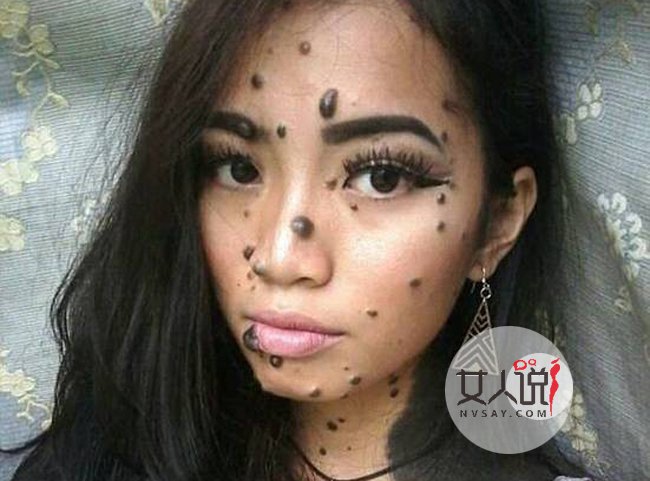 女子全身长满斑点 真人照片曝光很恐怖却满怀信心成环球小姐