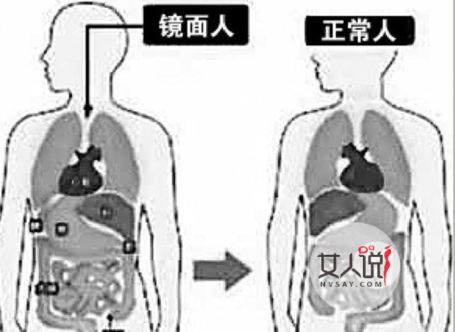 男子五脏六腑反长 背后真相曝光给医生动手术来个措手不及
