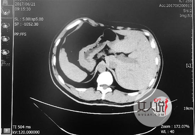 男子五脏六腑反长 背后真相曝光给医生动手术来个措手不及
