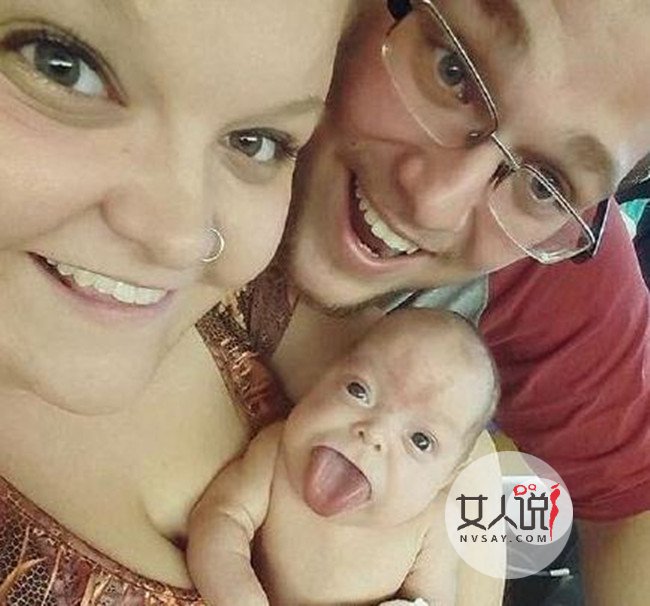 新生女婴长巨舌 惊人大舌头塞满嘴巴往外生长太可怕