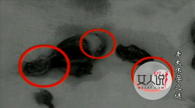 82岁老太突然怀孕 揭老蚌生珠真相始末令人惊呆不已