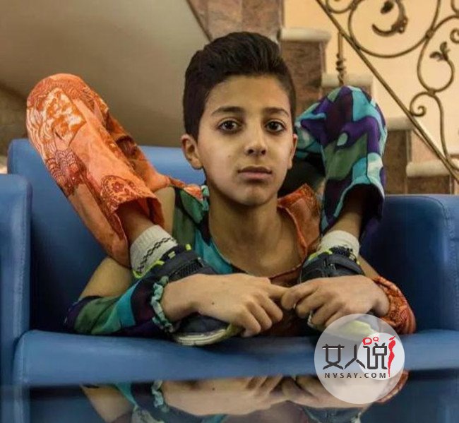 少年全身365度折叠 身体极度柔韧堪比“无骨人”令人称奇