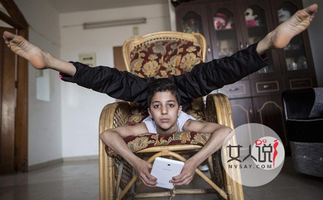 少年全身365度折叠 身体极度柔韧堪比“无骨人”令人称奇