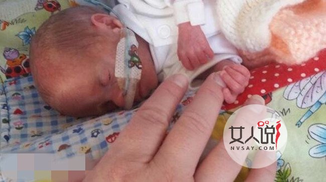 出生仅九两的婴儿奇迹存活 曾被医生断言无法存活下来