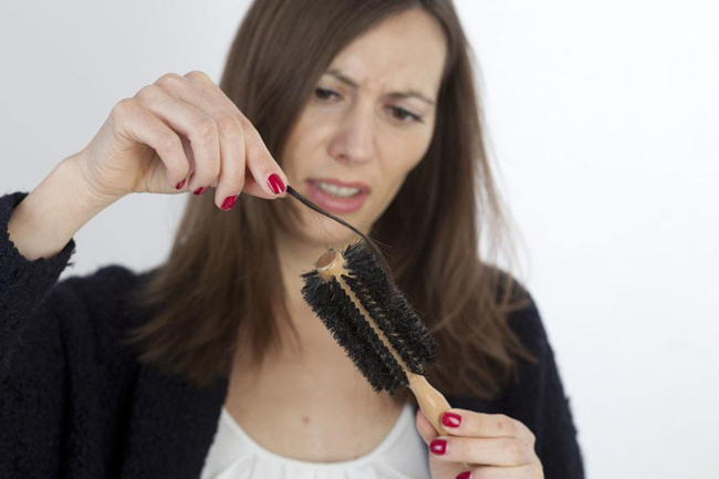 掉头发是什么原因 分享掉发原因不看就晚啦