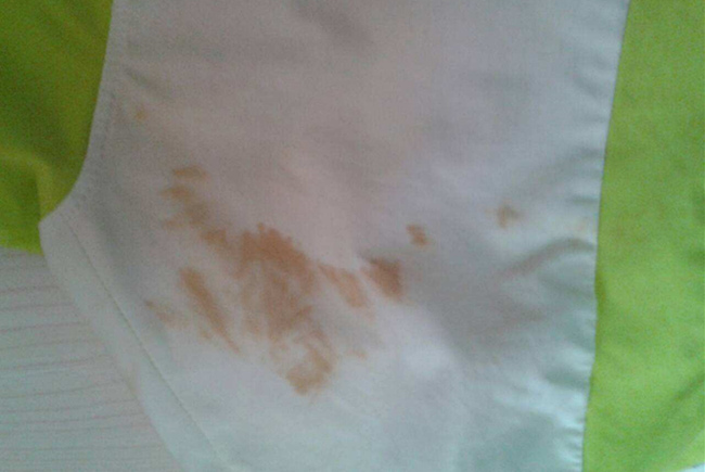 衣服染色怎么洗掉 5个妙招任何1个都能洗掉衣服染色地方