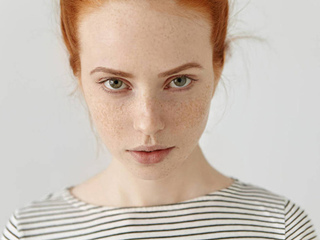 如何去掉脸上的斑点 三大简单妙招白净脸蛋向你挥手