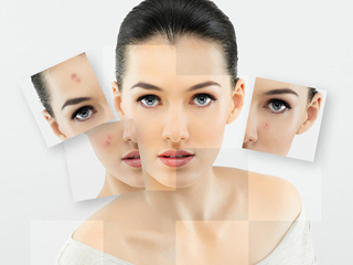 得了毛囊炎如何治疗好 毛囊炎的治疗小妙招饮食更重要