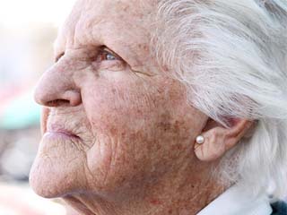 大蒜可以祛斑吗 别把大蒜不当回事祛斑杠杠的吓到你