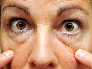 去下眼袋最好方法 消灭烦人眼袋方法戳进来