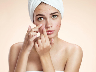 痘痘挤出来的是什么 痘痘里面的白色物体竟是这些东东