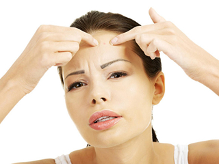 红色痘印怎么去除 常见痘印痤疮的淡化小妙招快速见效