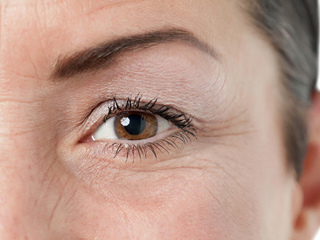 眼角纹是怎么形成的 加强保养在皮肤方面多留个心眼吧