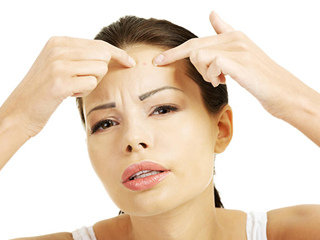 脸上长痘痘怎么办 祛痘不留印妙招让肌肤焕然一新