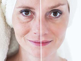 宫寒脸上会长黄褐斑吗 暖宫5步告别满脸斑点黄脸婆